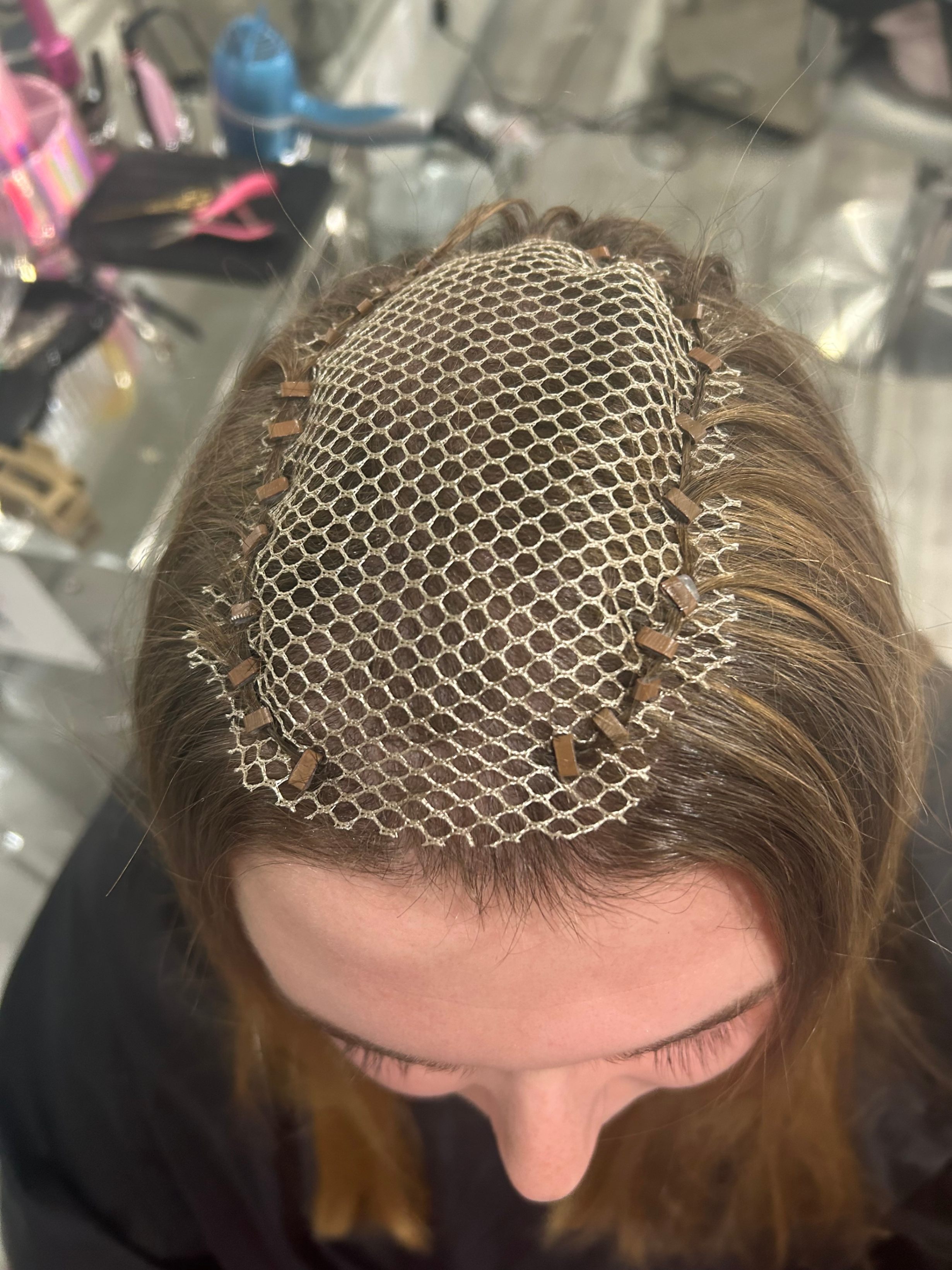 A woman with trichotillomania wearing a mesh integration hair system