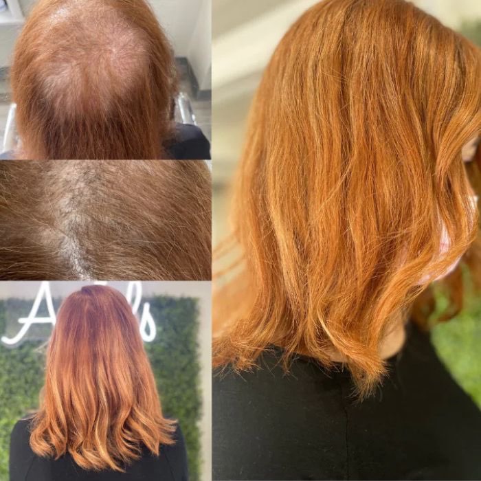 Wig hair loss solutions at Noelle salon
