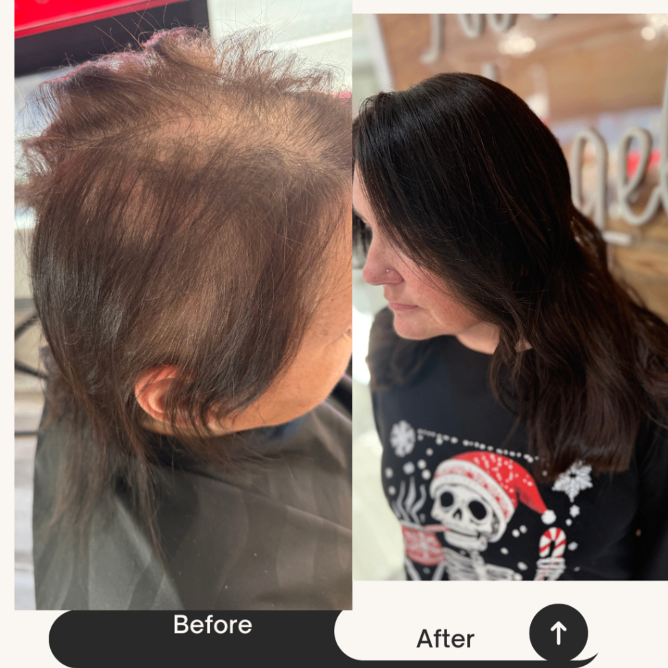 Example of natural hair density support using customized salon-based solutions.