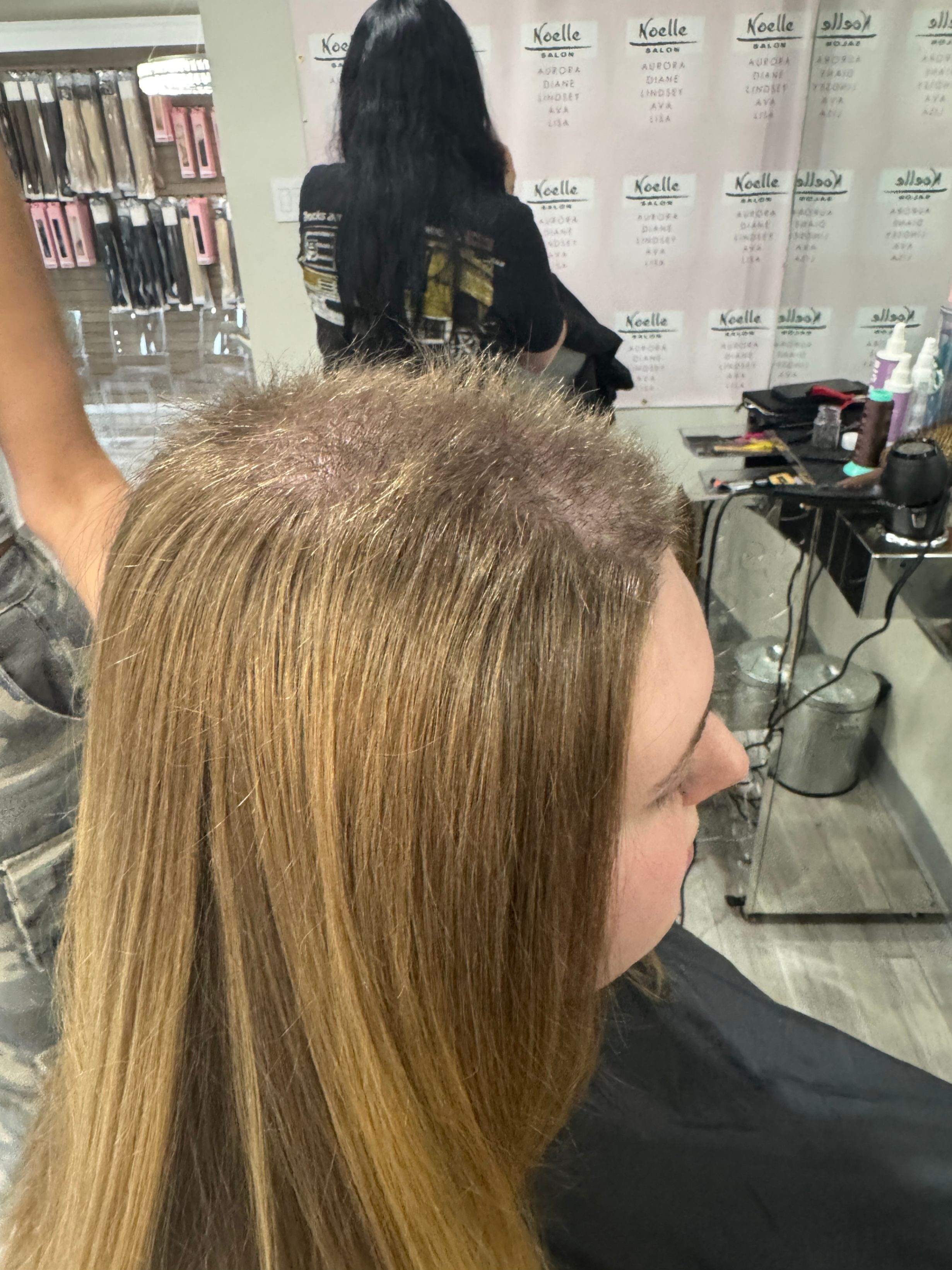 a young woman with trichotillomania